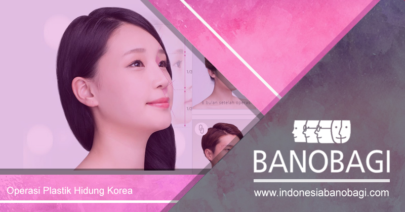 operasi plastik hidung korea